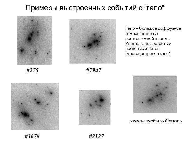 Примеры выстроенных событий с “гало” Гало – большое диффузное темное пятно на рентгеновской пленке.