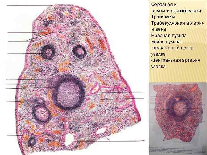 Серозная и волокнистая оболочки Трабекулы Трабекулярная артерия и вена Красная пульпа Белая пульпа: -реактивный