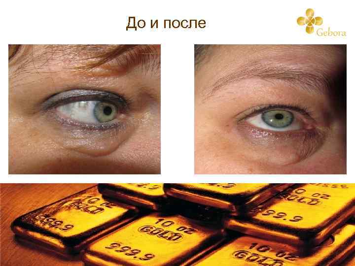 До и после 