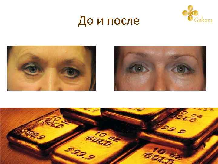 До и после 