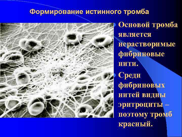 Формирование истинного тромба l Основой тромба является нерастворимые фибриновые нити. l Среди фибриновых нитей