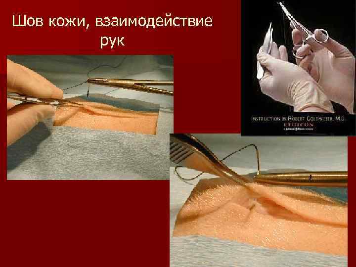 Шов кожи, взаимодействие рук 