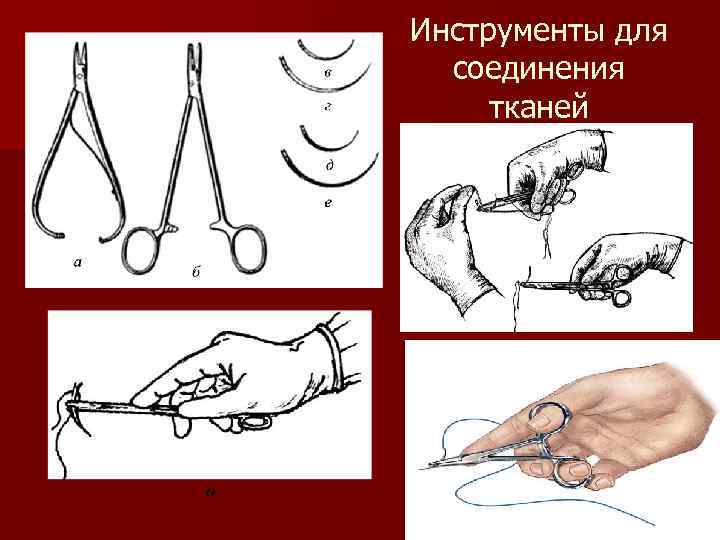 Инструменты для соединения тканей 