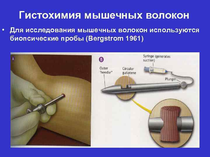 Гистохимия мышечных волокон • Для исследования мышечных волокон используются биопсические пробы (Bergstrom 1961) 