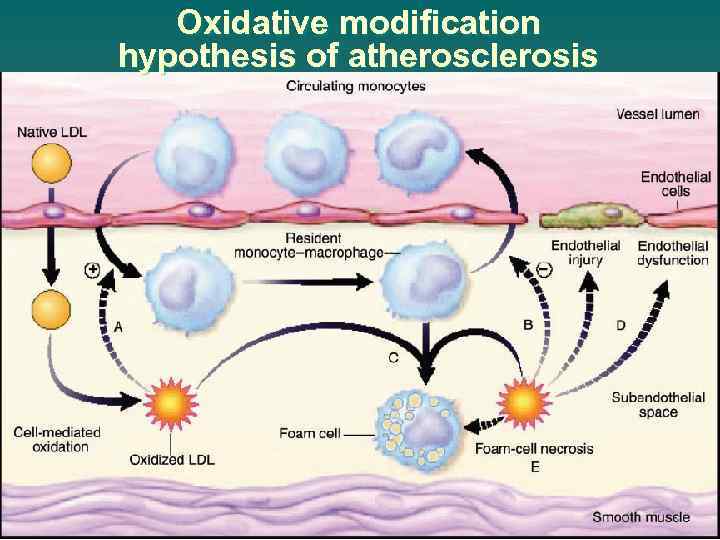 Oxidative modification hypothesis of atherosclerosis 