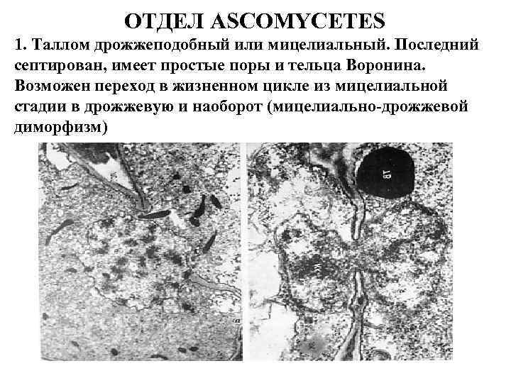 Имеют недифференцированный таллом могут иметь. Септированный мицелий. Мицелиальный таллом. Дрожжеподобный таллом. Мицелиально-дрожжевой диморфизм.