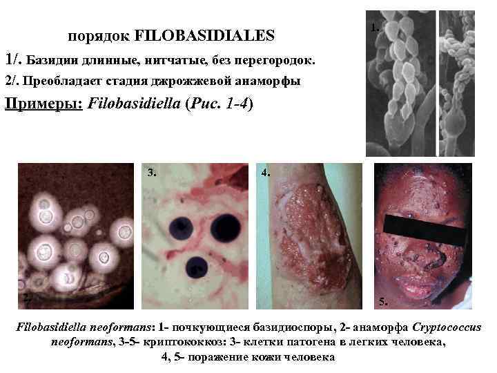порядок FILOBASIDIALES 1. 1/. Базидии длинные, нитчатые, без перегородок. 2/. Преобладает стадия джрожжевой анаморфы