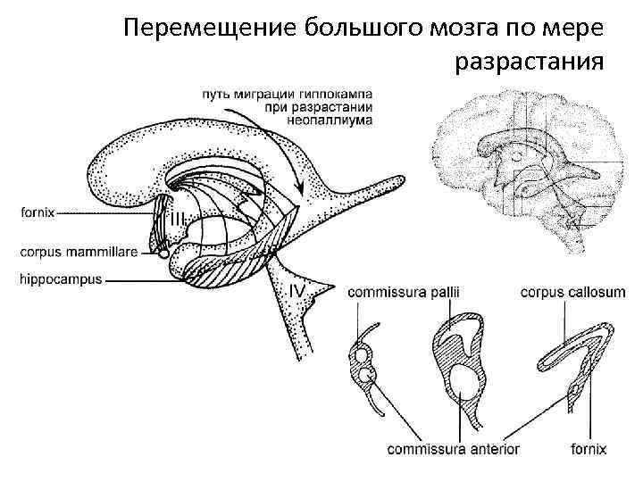 Перемещение большого мозга по мере разрастания 
