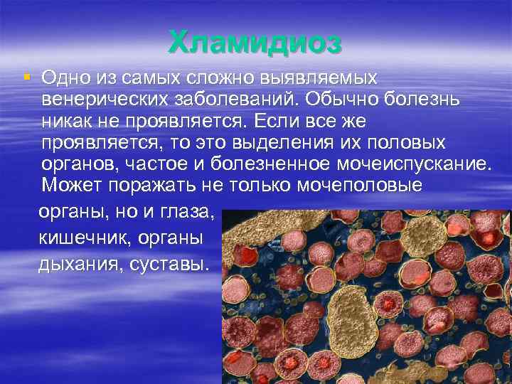 Хламидиоз § Одно из самых сложно выявляемых венерических заболеваний. Обычно болезнь никак не проявляется.