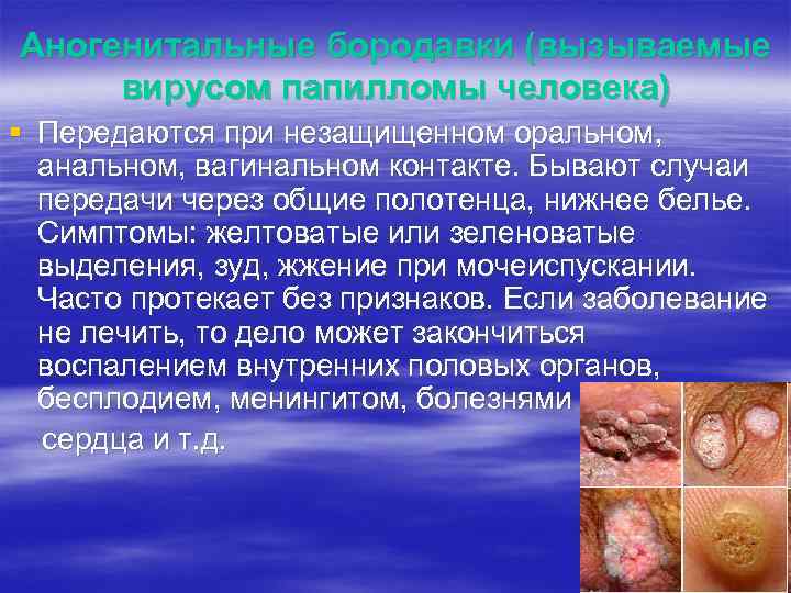Аногенитальные бородавки (вызываемые вирусом папилломы человека) § Передаются при незащищенном оральном, анальном, вагинальном контакте.