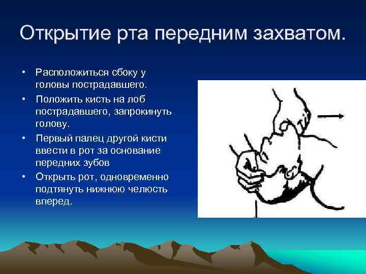Открытие рта передним захватом. • Расположиться сбоку у головы пострадавшего. • Положить кисть на