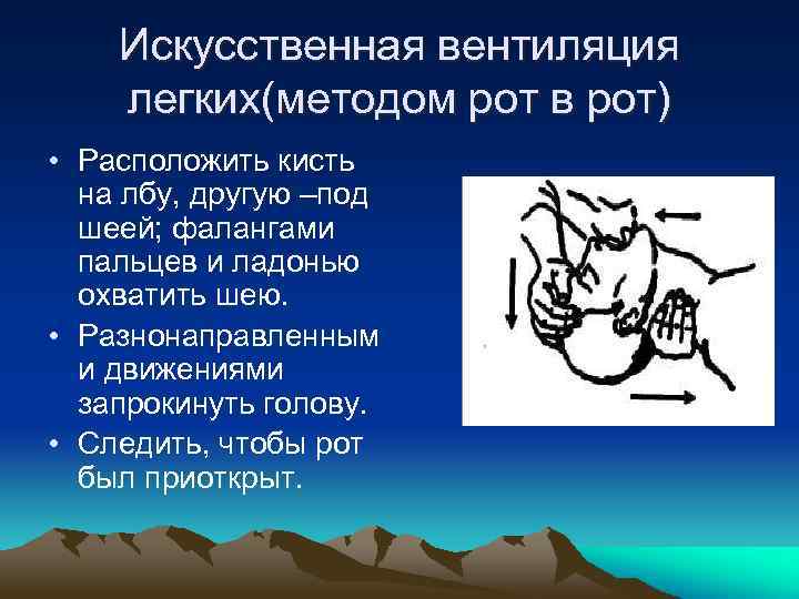 Искусственная вентиляция легких(методом рот в рот) • Расположить кисть на лбу, другую –под шеей;