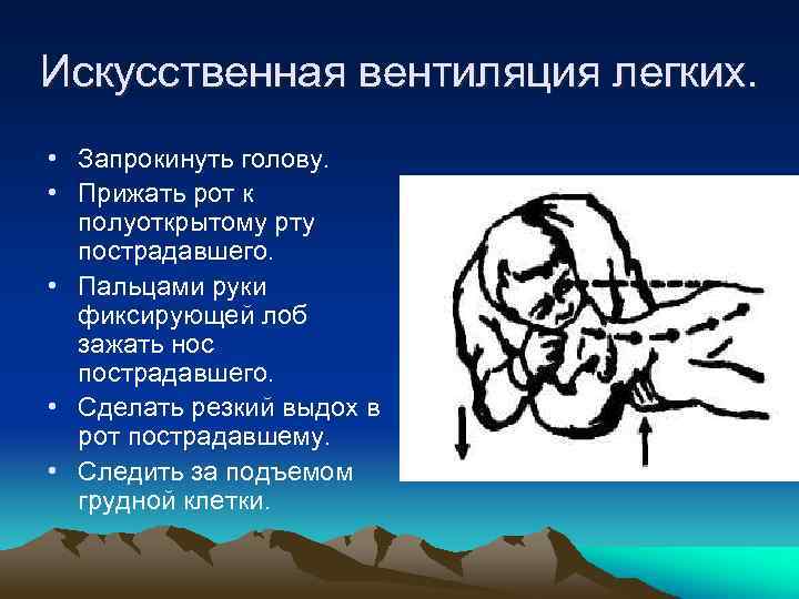 Искусственная вентиляция легких. • Запрокинуть голову. • Прижать рот к полуоткрытому рту пострадавшего. •