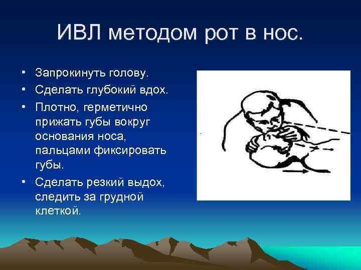 ИВЛ методом рот в нос. • Запрокинуть голову. • Сделать глубокий вдох. • Плотно,