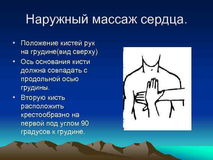 Как следует расположить руки на грудной клетке