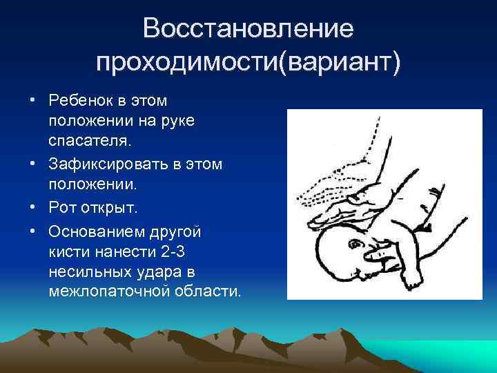 Восстановление проходимости(вариант) • Ребенок в этом положении на руке спасателя. • Зафиксировать в этом