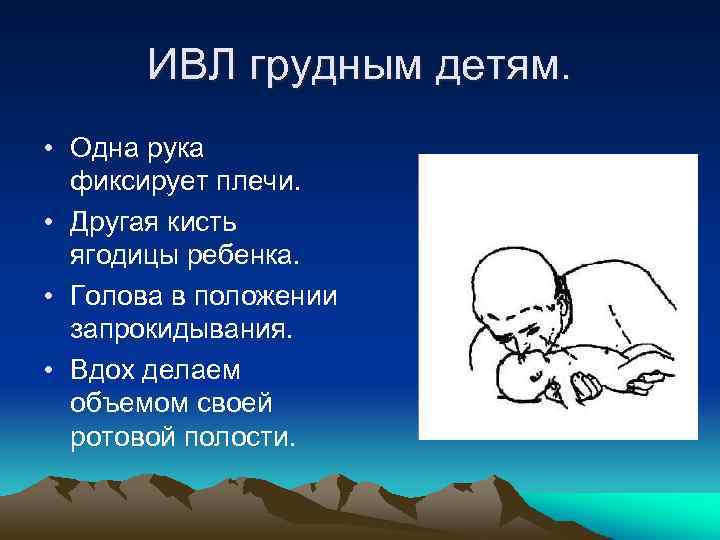 ИВЛ грудным детям. • Одна рука фиксирует плечи. • Другая кисть ягодицы ребенка. •