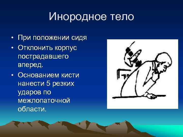 Инородное тело • При положении сидя • Отклонить корпус пострадавшего вперед. • Основанием кисти