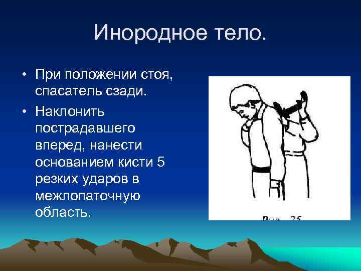 Инородное тело. • При положении стоя, спасатель сзади. • Наклонить пострадавшего вперед, нанести основанием