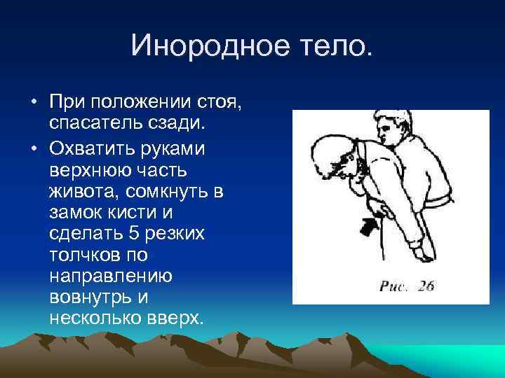 Инородное тело. • При положении стоя, спасатель сзади. • Охватить руками верхнюю часть живота,