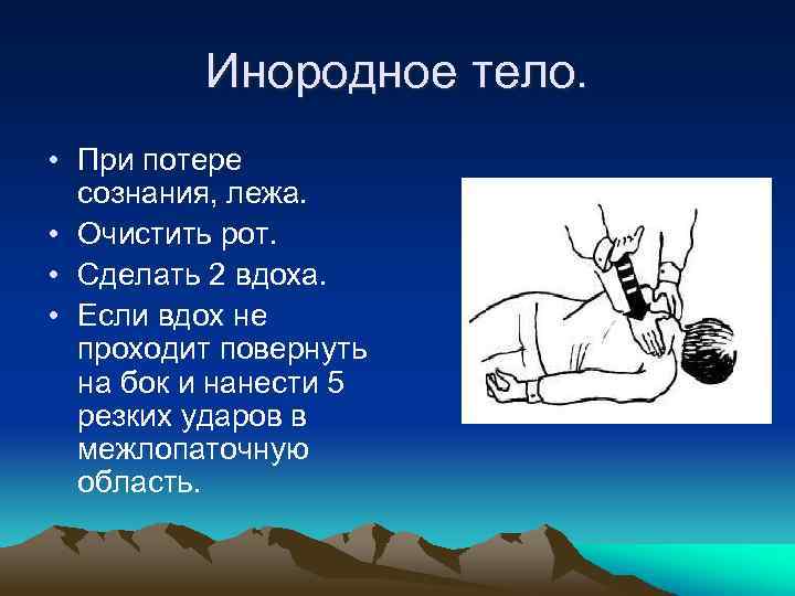 Инородное тело. • При потере сознания, лежа. • Очистить рот. • Сделать 2 вдоха.