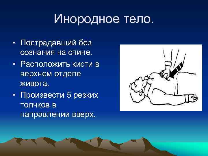 Инородное тело. • Пострадавший без сознания на спине. • Расположить кисти в верхнем отделе