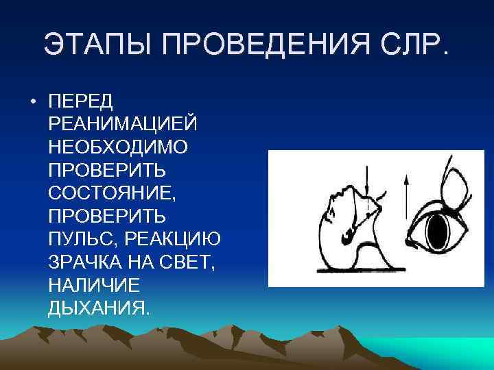 ЭТАПЫ ПРОВЕДЕНИЯ СЛР. • ПЕРЕД РЕАНИМАЦИЕЙ НЕОБХОДИМО ПРОВЕРИТЬ СОСТОЯНИЕ, ПРОВЕРИТЬ ПУЛЬС, РЕАКЦИЮ ЗРАЧКА НА