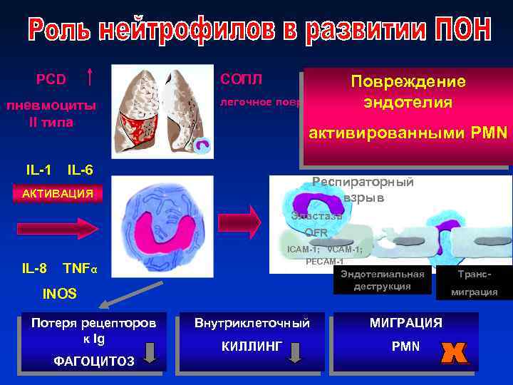 PCD СОПЛ пневмоциты ІІ типа IL-1 Повреждение легочное повреждение эндотелия активированными PMN IL-6 Респираторный