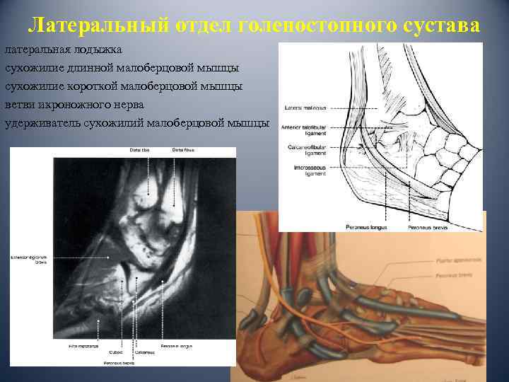 Латеральный отдел голеностопного сустава латеральная лодыжка сухожилие длинной малоберцовой мышцы сухожилие короткой малоберцовой мышцы