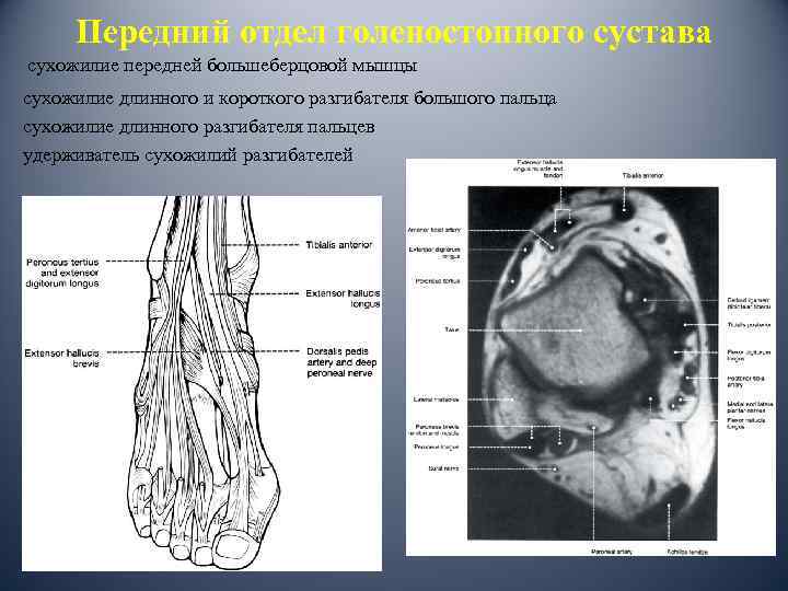 Передний отдел голеностопного сустава сухожилие передней большеберцовой мышцы сухожилие длинного и короткого разгибателя большого