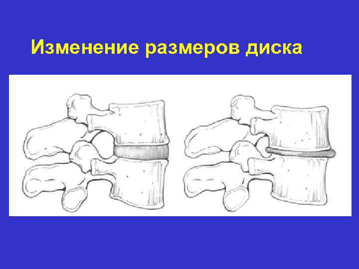 Изменение размеров диска 