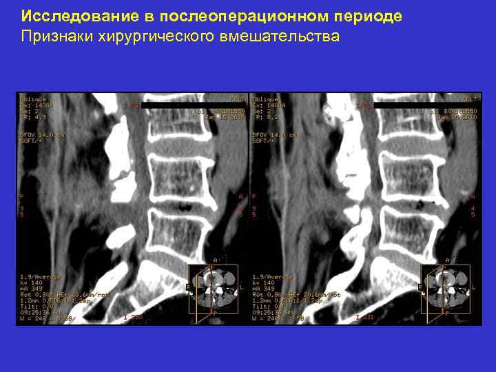 Исследование в послеоперационном периоде Признаки хирургического вмешательства 