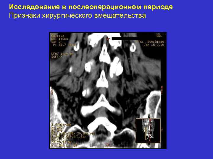 Исследование в послеоперационном периоде Признаки хирургического вмешательства 