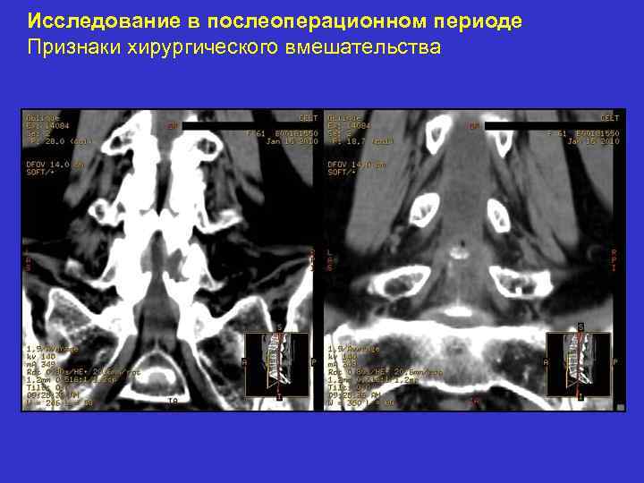 Исследование в послеоперационном периоде Признаки хирургического вмешательства 