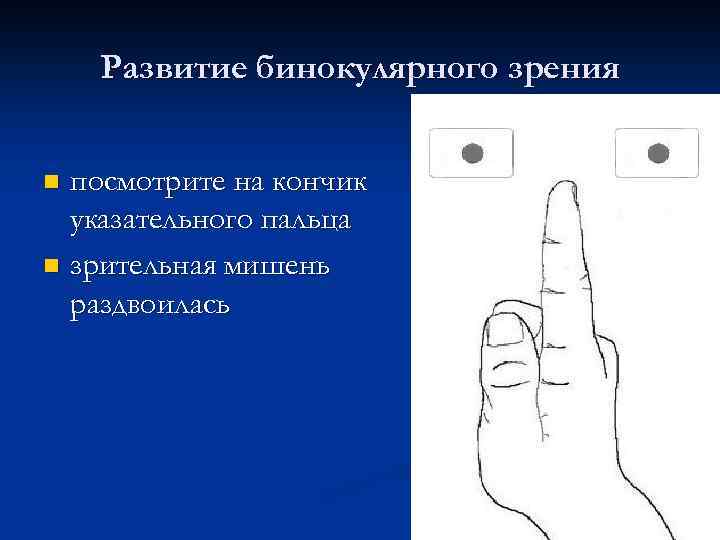 Развитие бинокулярного зрения посмотрите на кончик указательного пальца n зрительная мишень раздвоилась n 