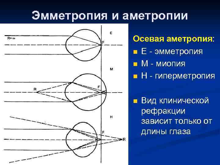 Схема рефракции нормального глаза