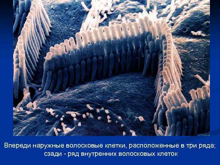 Впереди наружные волосковые клетки, расположенные в три ряда; сзади - ряд внутренних волосковых клеток