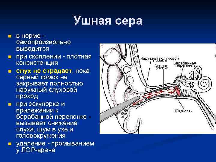 Ушная сера n n n в норме самопроизвольно выводится при скоплении - плотная консистенция