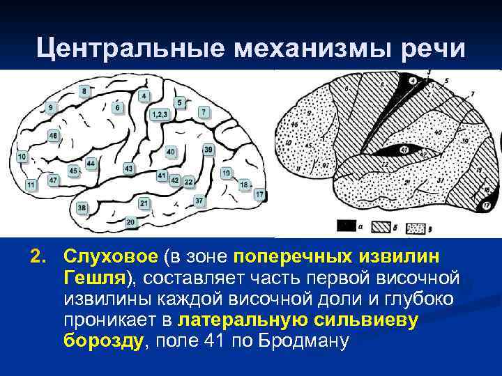 Височной извилины. Поперечная извилина Гешля.