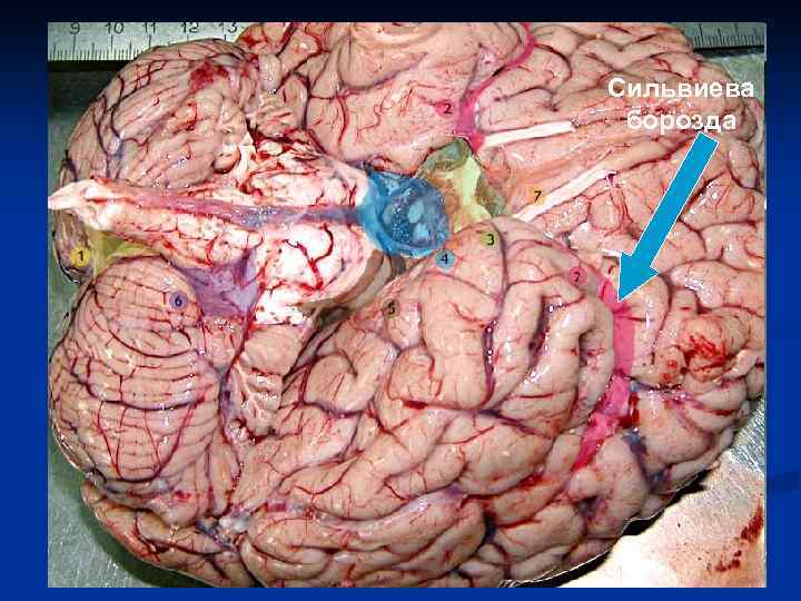 Сильвиева борозда 