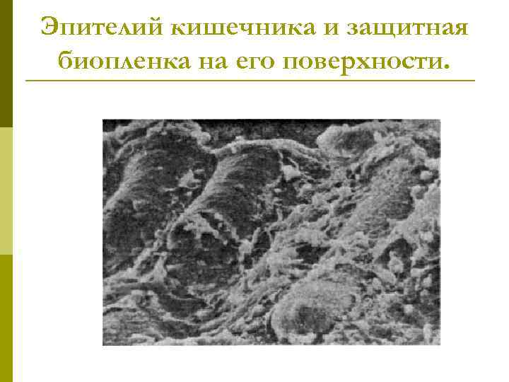 Эпителий кишечника и защитная биопленка на его поверхности. 