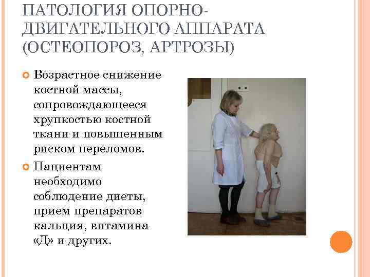 ПАТОЛОГИЯ ОПОРНОДВИГАТЕЛЬНОГО АППАРАТА (ОСТЕОПОРОЗ, АРТРОЗЫ) Возрастное снижение костной массы, сопровождающееся хрупкостью костной ткани и