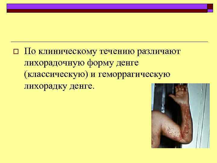 o По клиническому течению различают лихорадочную форму денге (классическую) и геморрагическую лихорадку денге. 