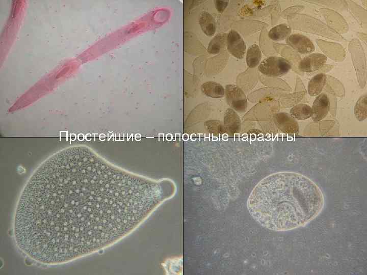 Простейшие – полостные паразиты 