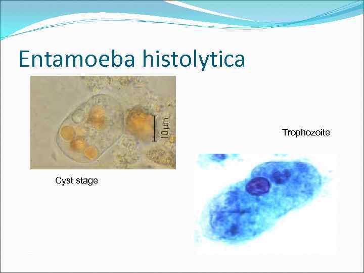 Entamoeba histolytica Trophozoite Cyst stage 