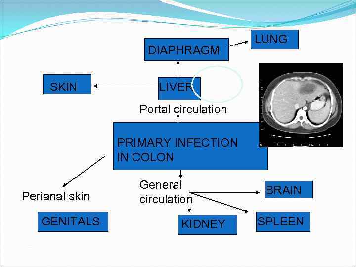 DIAPHRAGM SKIN LUNG LIVER Portal circulation PRIMARY INFECTION IN COLON Perianal skin GENITALS General