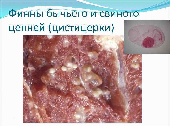 Финны бычьего и свиного цепней (цистицерки) 