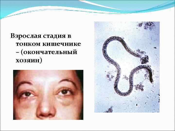 Взрослая стадия в тонком кишечнике – (окончательный хозяин) 