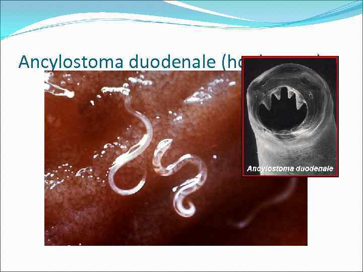Ancylostoma duodenale (hookworm) 