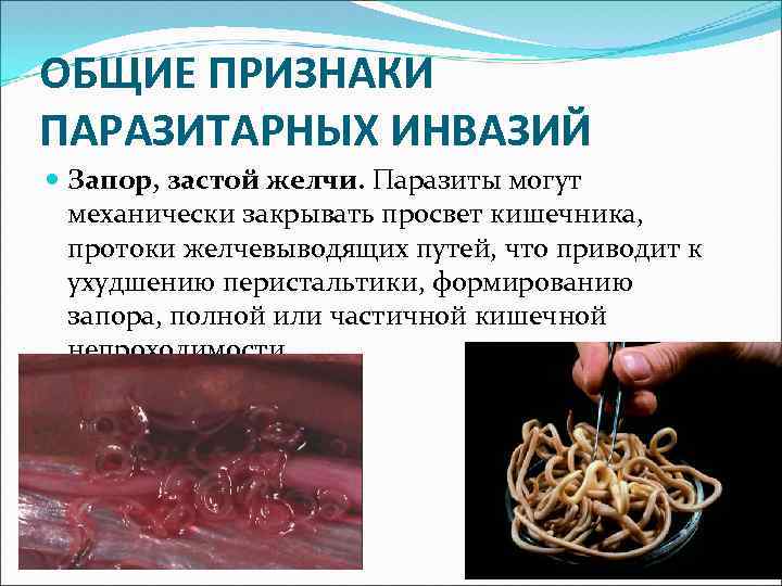 ОБЩИЕ ПРИЗНАКИ ПАРАЗИТАРНЫХ ИНВАЗИЙ Запор, застой желчи. Паразиты могут механически закрывать просвет кишечника, протоки